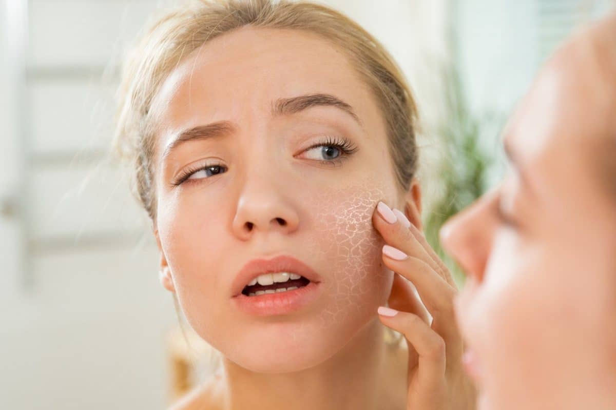 How To Combat Dry Winter Skin - Face Doctor