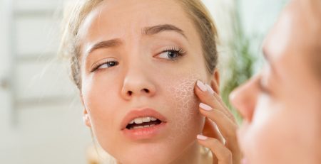 How to Combat Dry Winter Skin