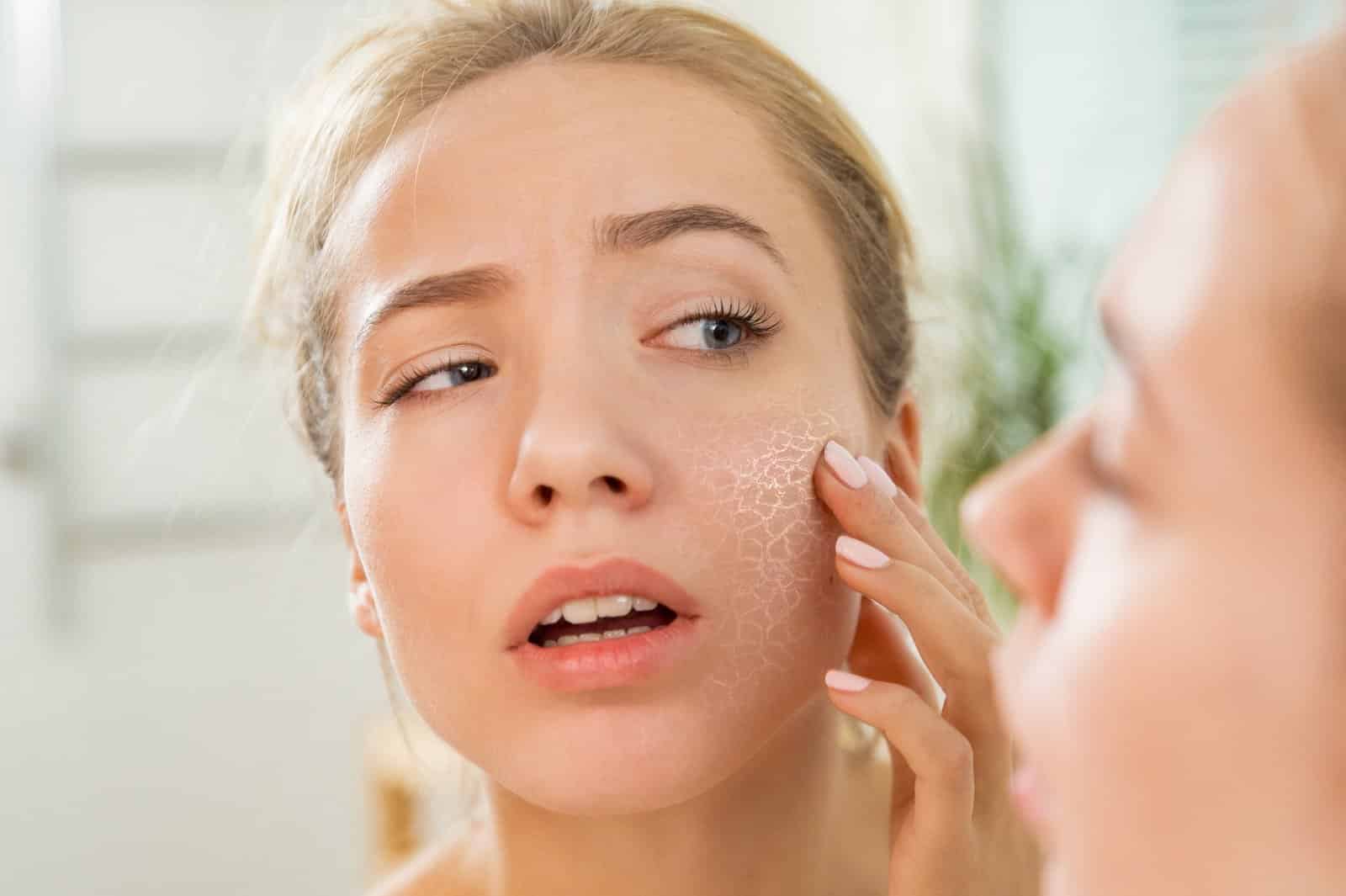 How To Combat Dry Winter Skin Face Doctor 